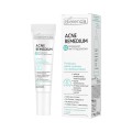 Точкова цинкова паста проти недосконалостей - ACNE REMEDIUM